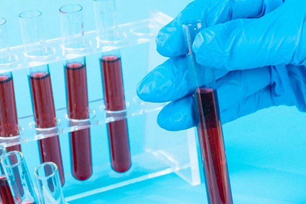 血痕做亲子鉴定要用干的还是新鲜的