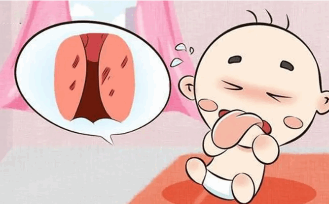 羊水穿刺亲子鉴定的原理及危险